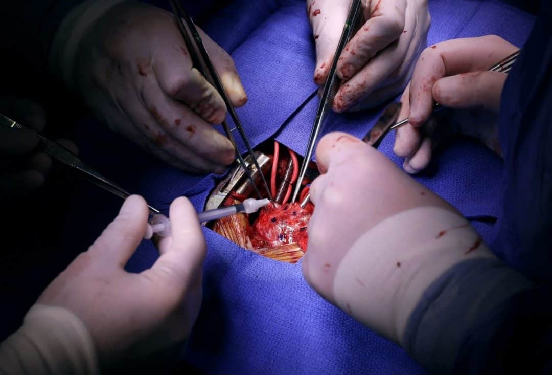 Scientists have figured out exactly how much you need to exercise to slow your heart’s aging process