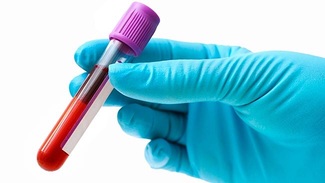 Blood donation lowers calories, improves body fitness