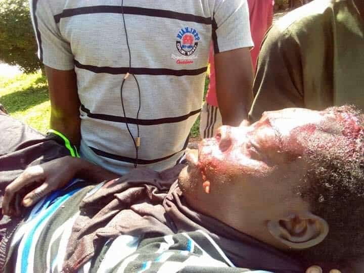 PDP Calls On NASS, International Community To Probe Killing Of Protesters By Troops