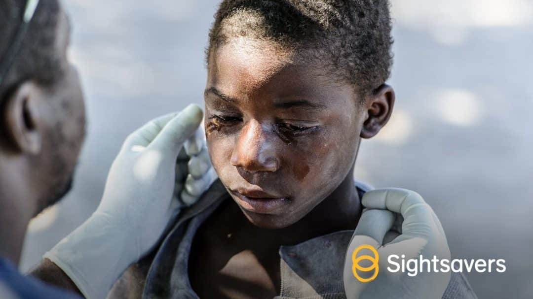 Nigeria Still Denying 25 Million Citizens With Disabilities Basic Rights, Group Says
