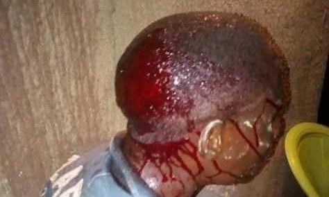 PDP Wants APC Leaders Questioned Over Election Killings, Violence