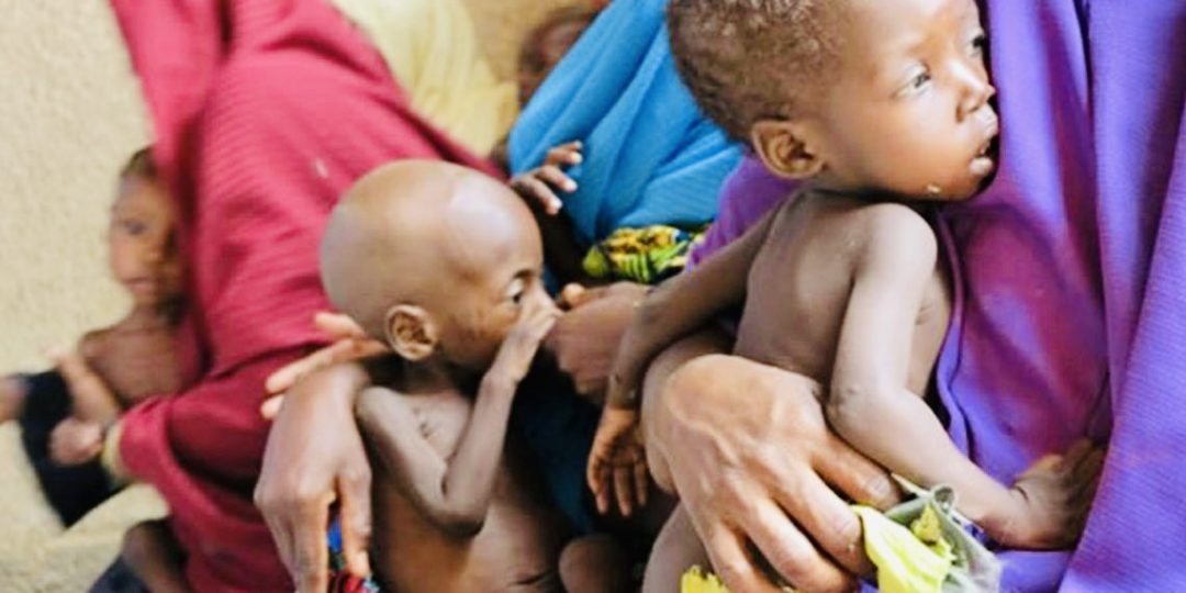 UNICEF Report Chronicles How Over 1.2m Under-5 Children Are Stunted In Katsina