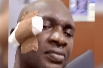 Abia Majority Leader Accused of Bottle Attack After Cash Row